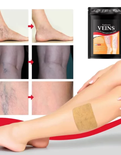 Patch de traitement des varices