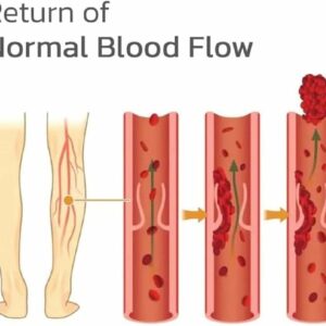 Patch de traitement des varices