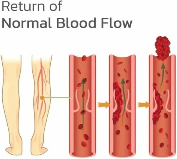 Patch de traitement des varices