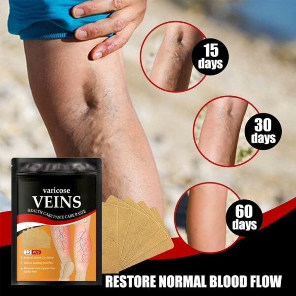 Patch de traitement des varices