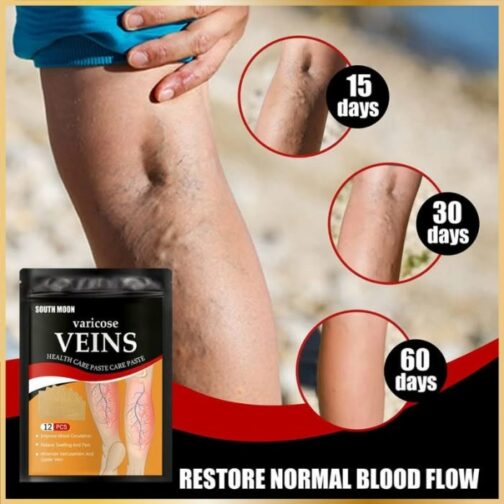Patch Varices Naturel – Soulagement & Circulation (12 pcs)