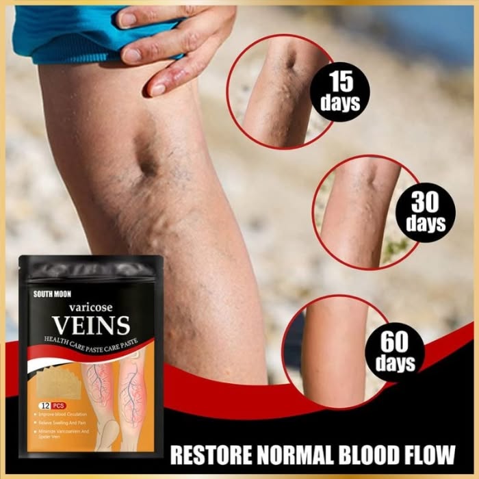 Patch Varices Naturel – Soulagement & Circulation (12 pcs) - 3
