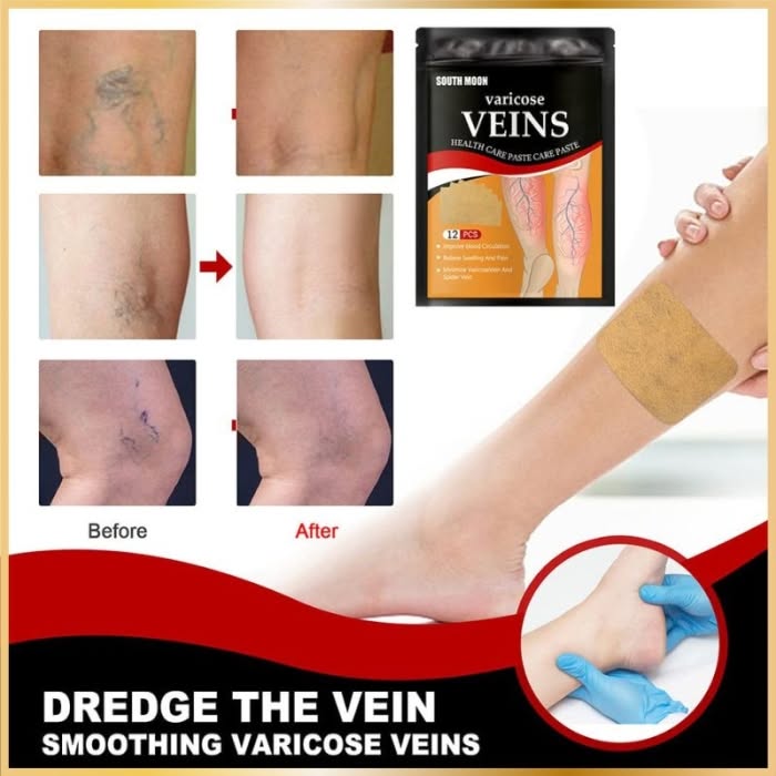 Patch Varices Naturel – Soulagement & Circulation (12 pcs) - 7