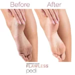 Flawless-Pedi-Appareil-de-pedicure-electrique-5