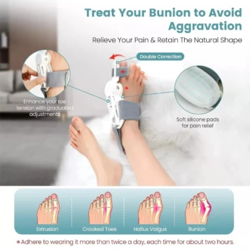 Orthèse Correctrice d’Orteil Hallux Valgus Ajustable FeetiFix – Forsa-Store