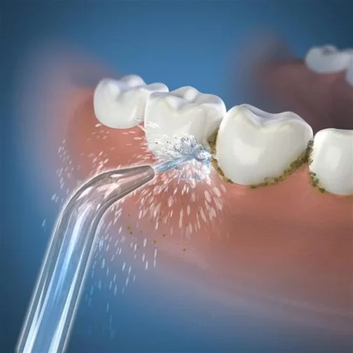 جهاز تنظيف الأسنان بالماء اللاسلكي – الابتكار الذي يمنحك تنظيفًا عميقًا ودقيقًا خلال ثوانٍ فقط! – 3- Forsa-store