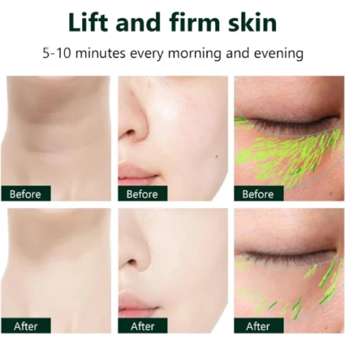 Appareil de Massage Facial Multifonctionnel 3en1 GUSHIYUTA